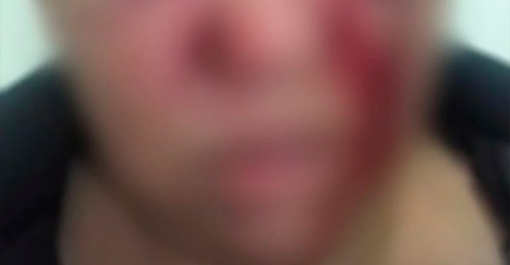 Mãe é agredida pelo próprio filho e tem o celular furtado