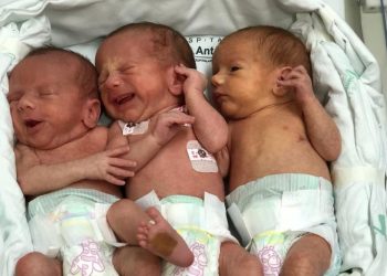 Caso raro: Trigêmeos idênticos que nasceram em SC já receberam alta