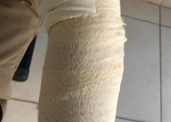 Policiais são atacados com pedra e objetos. Um deles ficou ferido