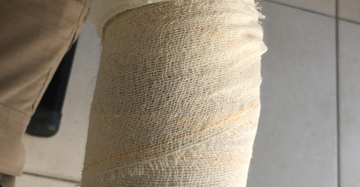 Policiais são atacados com pedra e objetos. Um deles ficou ferido