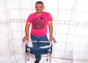 Morador da região precisa de ajuda após perder perna e pé