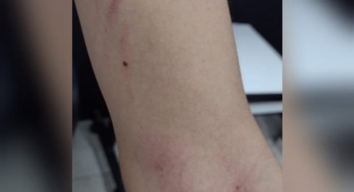 Homem é preso ao agredir mulher em Nova Trento