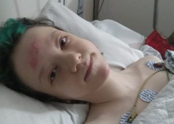 Dia D chegou e Duda se recupera da cirurgia para corrigir Escoliose Idiopática