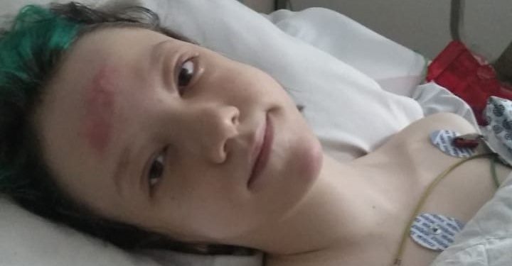 Dia D chegou e Duda se recupera da cirurgia para corrigir Escoliose Idiopática