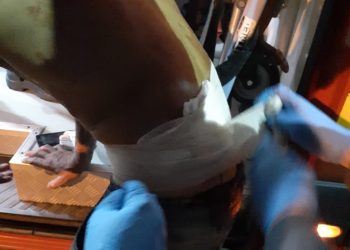 Tentativa de homicídio deixa vítima gravemente ferida, em São João Batista