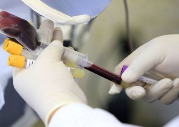 Novo caso de varíola dos macacos é confirmado em São João Batista