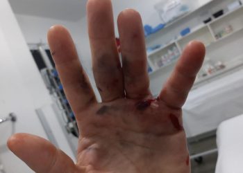 Homem sofre ferimento de arma de fogo em São João Batista