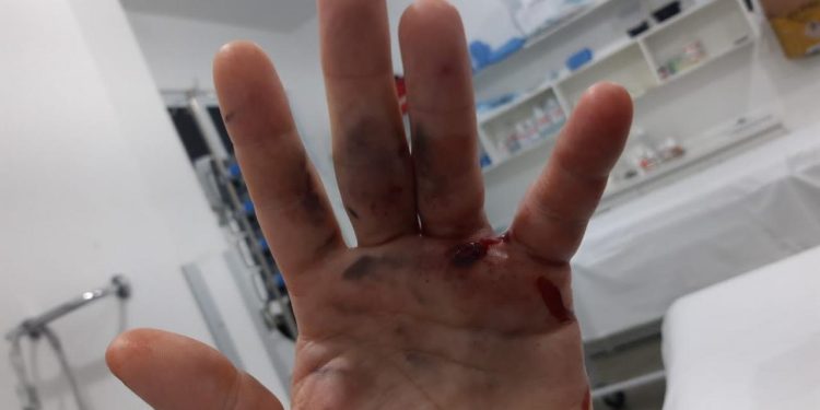 Homem sofre ferimento de arma de fogo em São João Batista