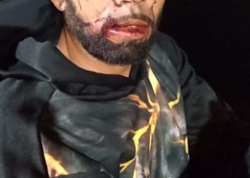 Homem tenta furtar carro, é contido por vizinhos e se machuca