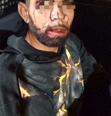 Homem tenta furtar carro, é contido por vizinhos e se machuca