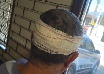 Homem fica ferido após ser atingido por pedra em Canelinha
