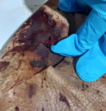 Homem leva tiro no pé após um desentendimento relacionado a propriedade de um terreno em Tijucas