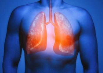 Nova vacina contra o câncer de pulmão demonstra um resultado sem precedentes, reduzindo em 41% o risco de mortalidade em pacientes