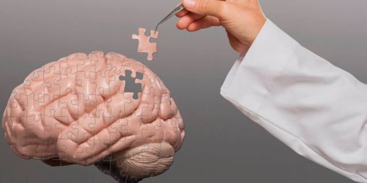 Exame inovador para detecção precoce da doença de Alzheimer chega ao Brasil esta semana