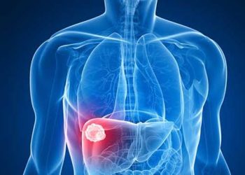 Florianópolis anuncia surto de Hepatite A