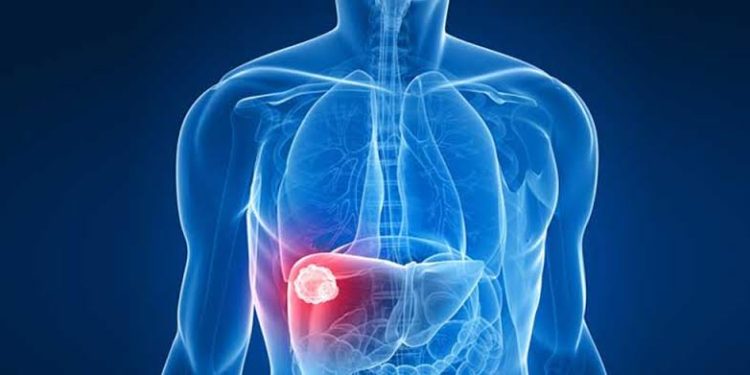 Florianópolis anuncia surto de Hepatite A