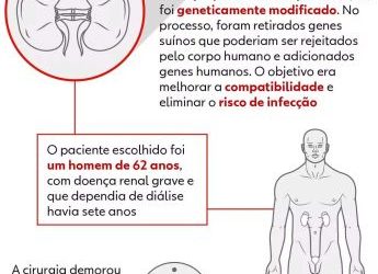 Cirurgia histórica: Médico brasileiro lidera inédito transplante de rim suíno para paciente humano nos Estados Unidos