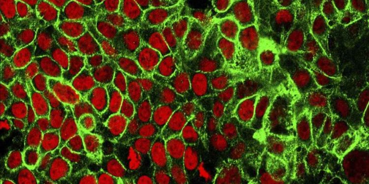 Estudo aponta queda de até 37% na taxa de mortalidade por câncer ao longo de 25 anos no Reino Unido