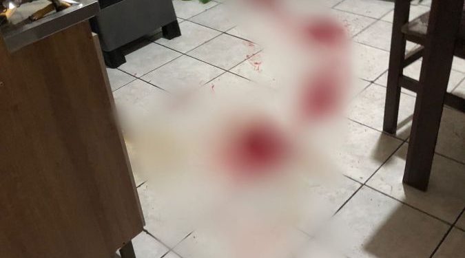 Tentativa de Homicídio : Homem é baleado na perna no bairro Praça Tijucas