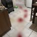 Tentativa de Homicídio : Homem é baleado na perna no bairro Praça Tijucas