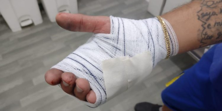 Homem leva golpe de faca no Centro de São João Batista