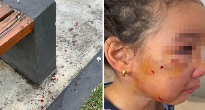 Dono de pit bull solto na rua é preso após o animal atacar uma criança de três anos em Navegantes