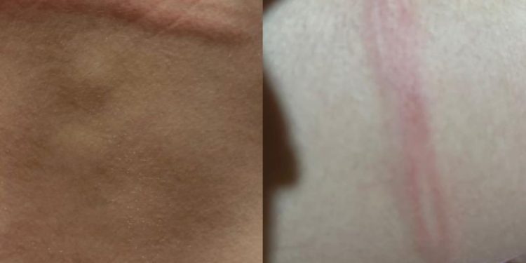 Casal é preso na Ribanceira do Sul por suspeita de agressão e abuso de adolescente de 15 anos em SJB